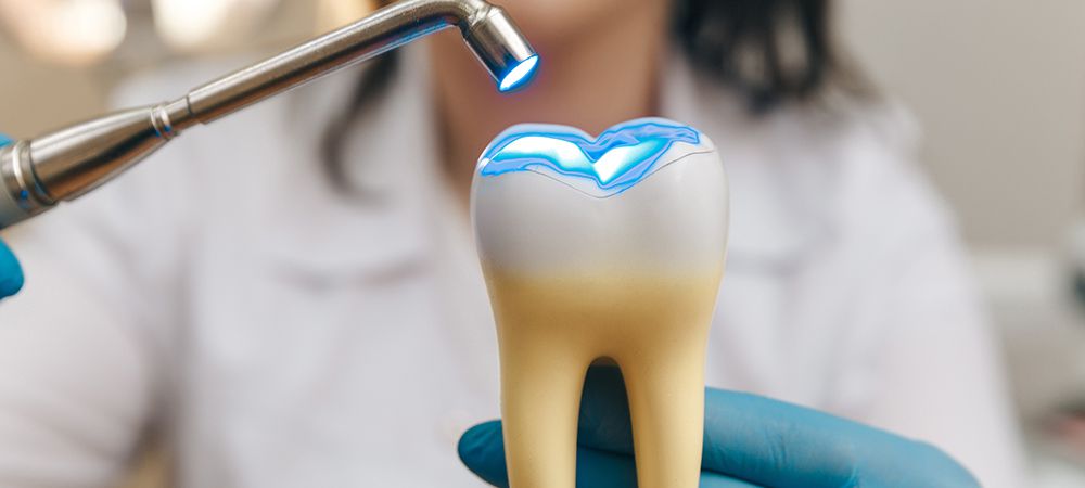 what is the cost of getting dental fillings in toronto