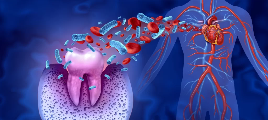 link between oral health and heart disease