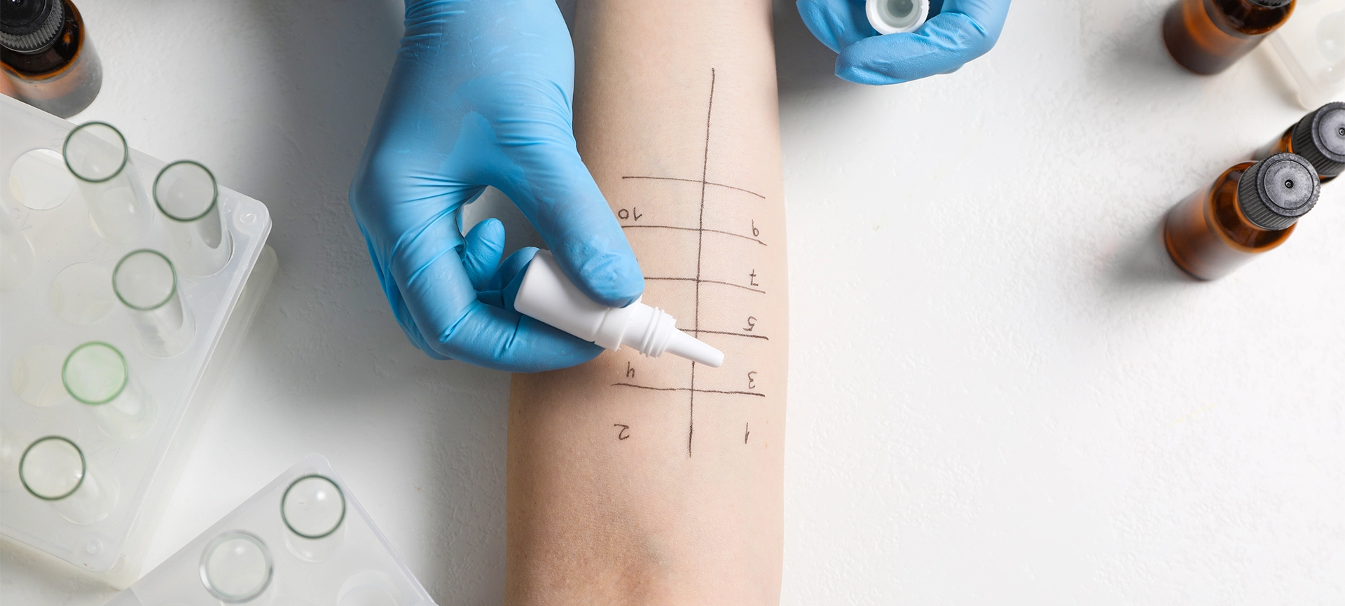 doctor doing skin allergy test at light table, top view