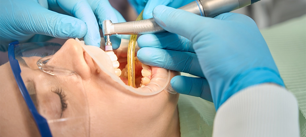 Close-up of doctor hands in nitrile gloves polishing female patient anterior teeth with nylon bristle brush