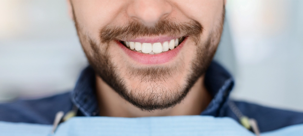 Closeup of man dental clinic patient white healthy smile, unrecognizable bearded man with napkin on his chest showing his beautiful smile, showing result of treatment at modern dentistry