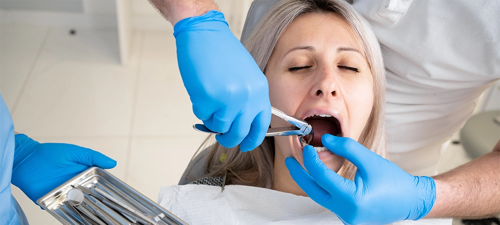 close-up of the poor girl's mouth in the bib of the patient in the dental clinic. A dentist in blue latex gloves removes her tooth with a buccal retractor and forceps.